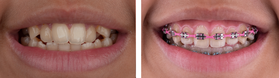 dental braces in dubai | dental braces in dubai | cosmetic dentistry dubai | oral and maxillofacial surgeon dubai | maxillofacial surgery dubai | cosmetic dentistry services in dubai
